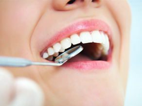 General Dentistry Services in Fort Myers