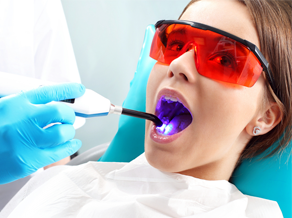 Tooth-Colored Fillings in Fort Myers